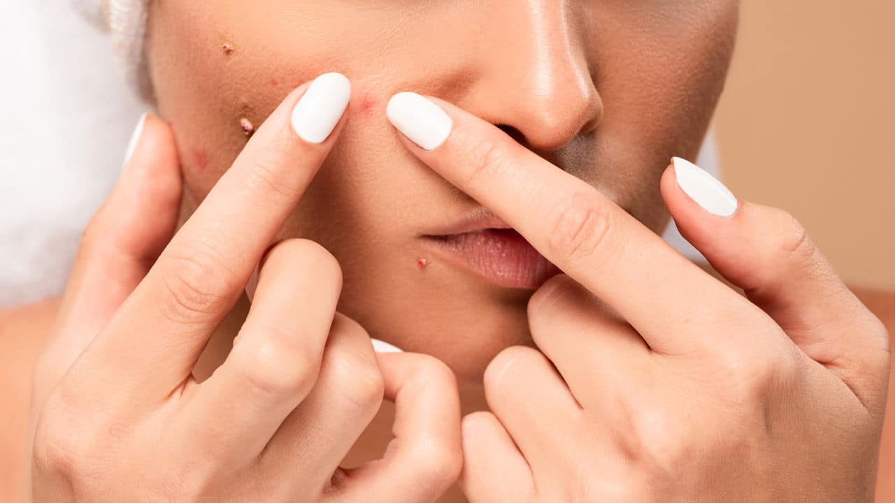espinhas e manchas: quando sua pele decide ter vida própria